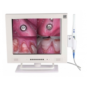 MLG WIFI Intra Oral Camera M-958A 15 inch LCD 1/4 SONY CCD