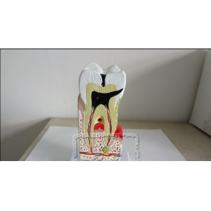 Dental Teeth Model