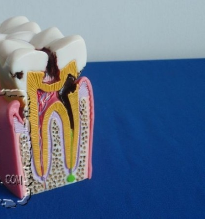 Dental Teeth Model