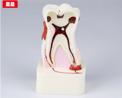 Dental Teeth Model