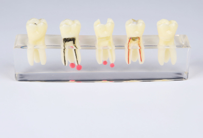 Dental Teeth Model