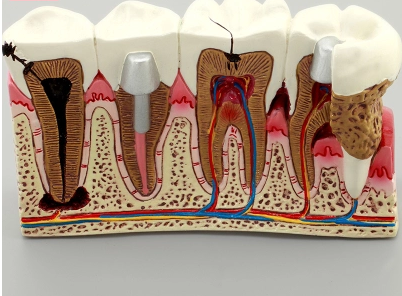 Dental Teeth Model