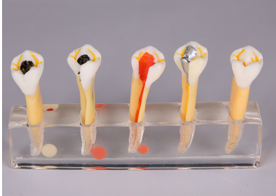 Dental Teeth Model