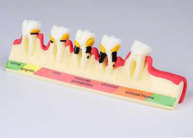 Dental Teeth Model