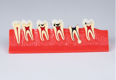 Dental Teeth Model